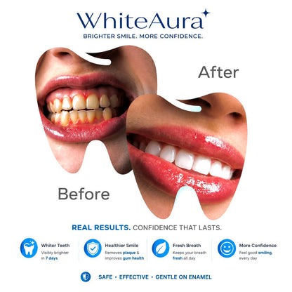 WhiteAura™ Smart Electric Toothbrush